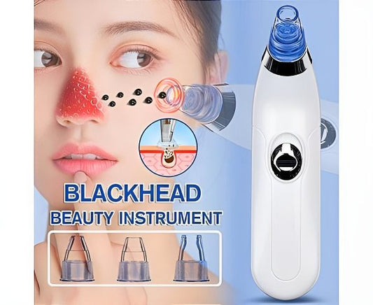 Derma Suction Blackheads Remover 3 In 1 Black Head Remover Machine-acne Pimple Pore Cleaner Vacuum Suction Tool (cell Operated)